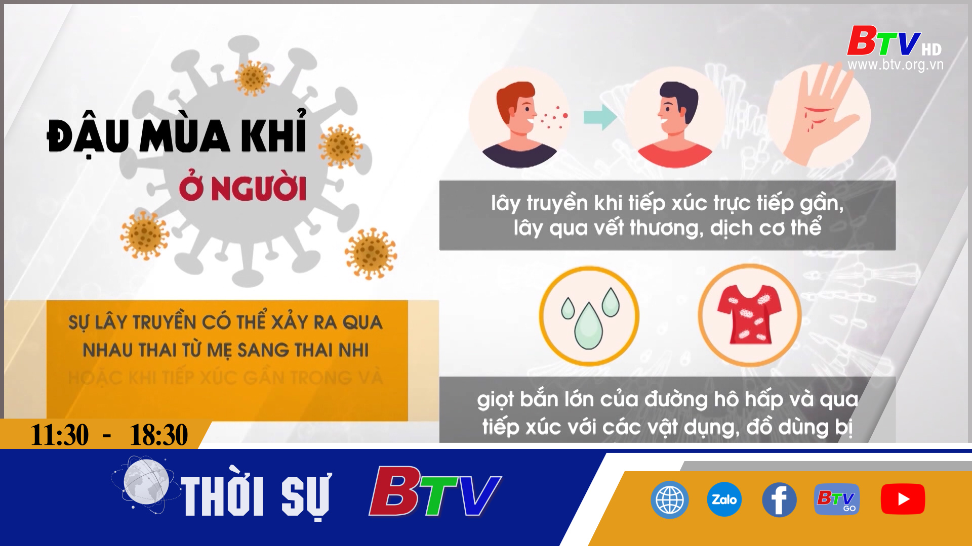 Nguy cơ xâm nhập đậu mùa khỉ vào Việt Nam