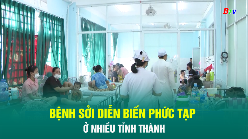 Bệnh sởi diễn biến phức tạp ở nhiều tỉnh thành