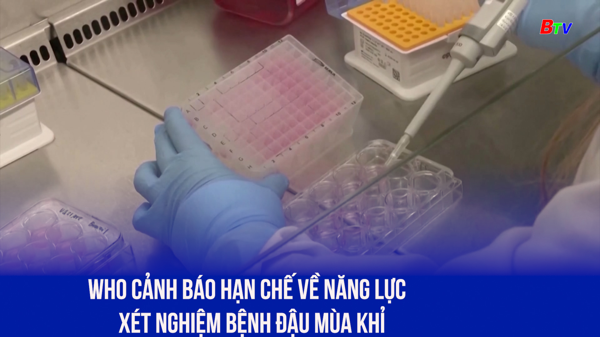 WHO cảnh báo hạn chế về năng lực xét nghiệm bệnh đậu mùa khỉ