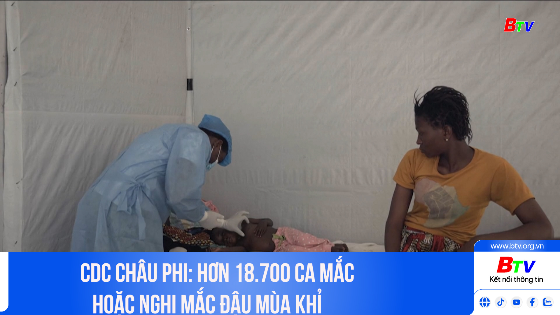 CDC châu Phi: Hơn 18.700 ca mắc hoặc nghi mắc đậu mùa khỉ